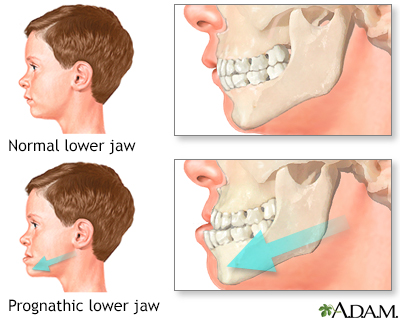 How to Extend Your Jaw and Improve Your Facial Structure Naturally
