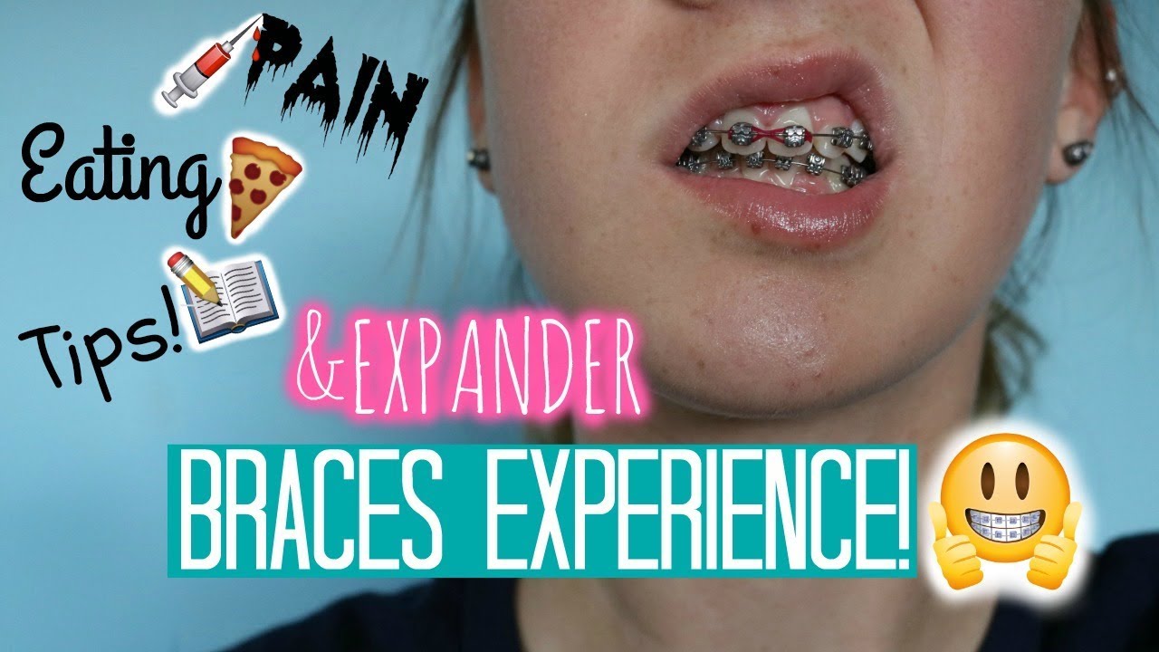 Why Does My Expander Hurt When I Eat – Understanding the Discomfort and Finding Relief