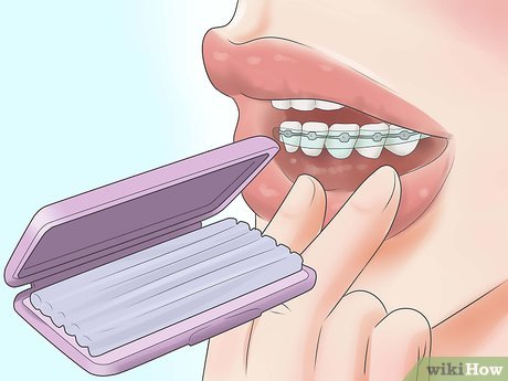 Learn the Best Techniques for Swallowing with an Expander and Improve Your Oral Health